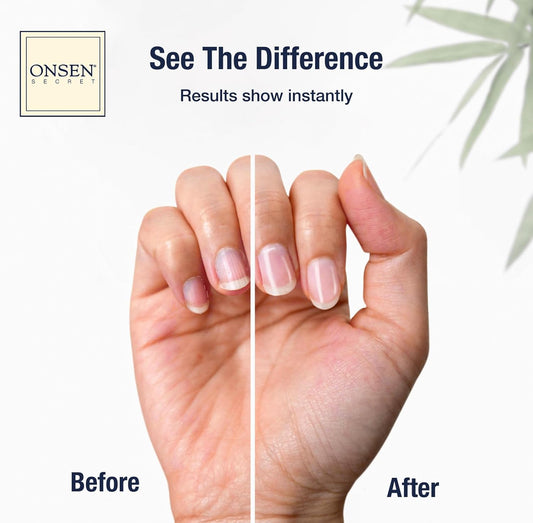 Onsen Nail & Cuticle Cream Treatment W/Japanese Tsubaki, Jojoba & Lavender Oil, Shea Butter – Strengthens Nails, Softens Cuticles - Daily Repair Care (2 Count/15 Ml)