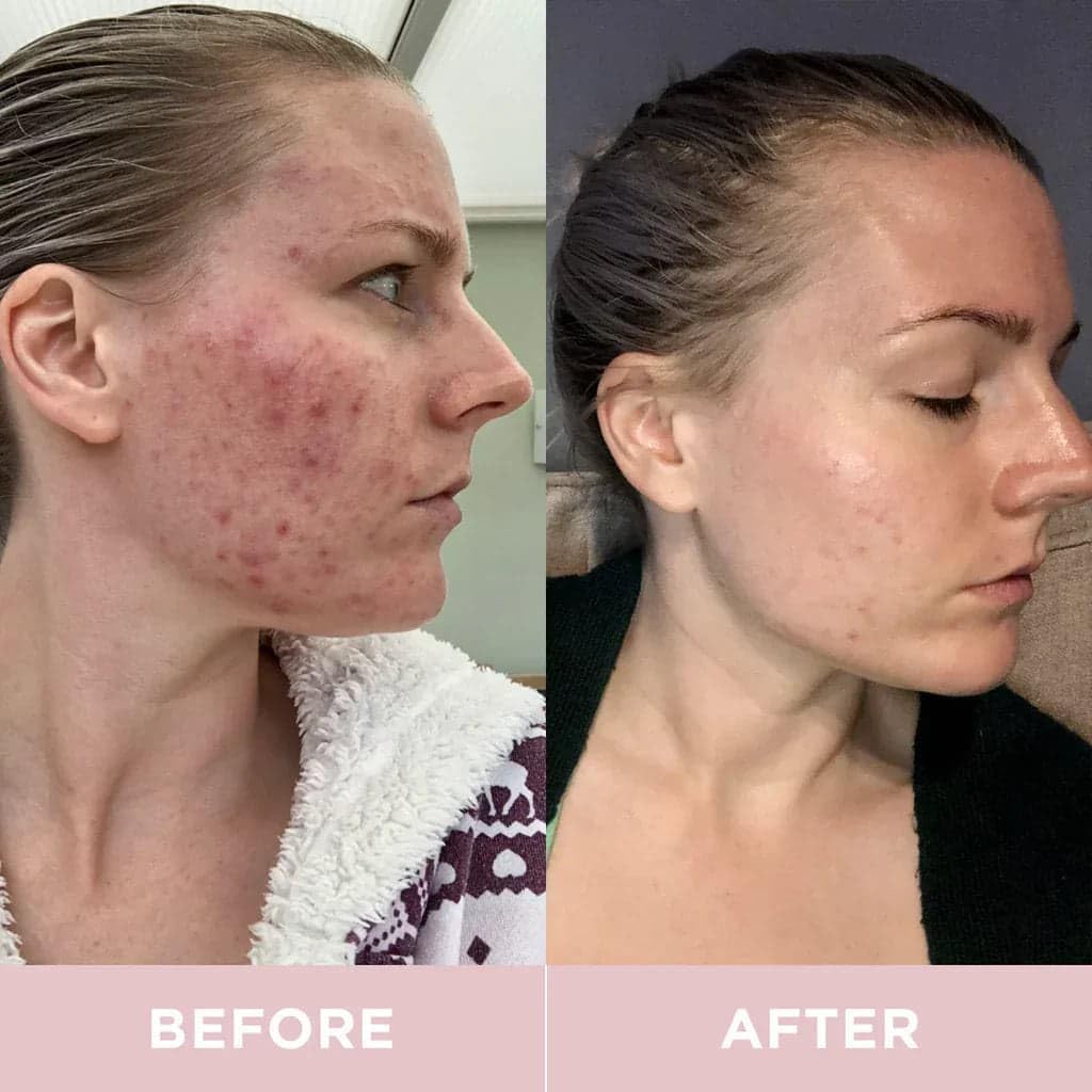 Revive Collagen Premium 8,500mg Hydrolysed Marine Collagen Drink with Added Hyaluronic Acid & Aloe Vera for Healthy Skin, Hair, Nails & Joints | Lemon & Lime | 14 x Sachets (Eco Pack) : Amazon.co.uk: Health & Personal Care