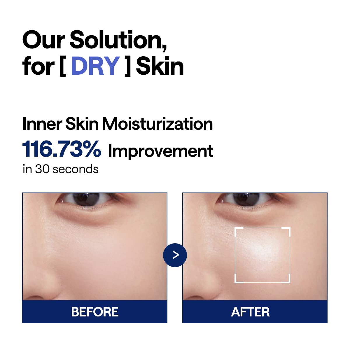 Mediheal Teatree Trouble Facial Toner Pads With Tea Tree & Lactobacillus - Calming & Soothing For Sensitive & Acne Prone Skin - Vegan Face Gauze, 100 Pads : Beauty & Personal Care