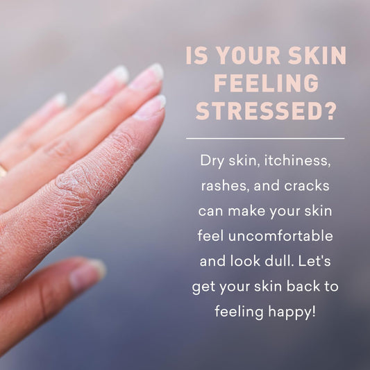 Just Nutritive Skin Calming & Healing Lotion | Organic Moisturizer For Treatment Of Dry, Cracked Or Irritated And Itchy Skin | Eczema Lotion Provides Long-Lasting Relief 16 Oz