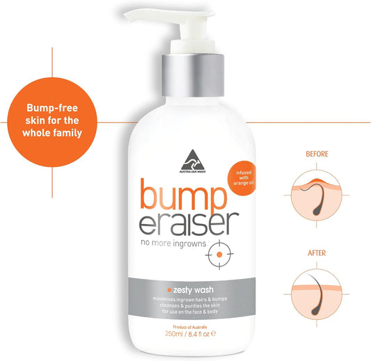 Bump Eraiser Zesty Wash 250 Ml For Body And Face Ingrown Hair Treatment, Razor Bumps, Razor Burns And Hair Growth Prevention
