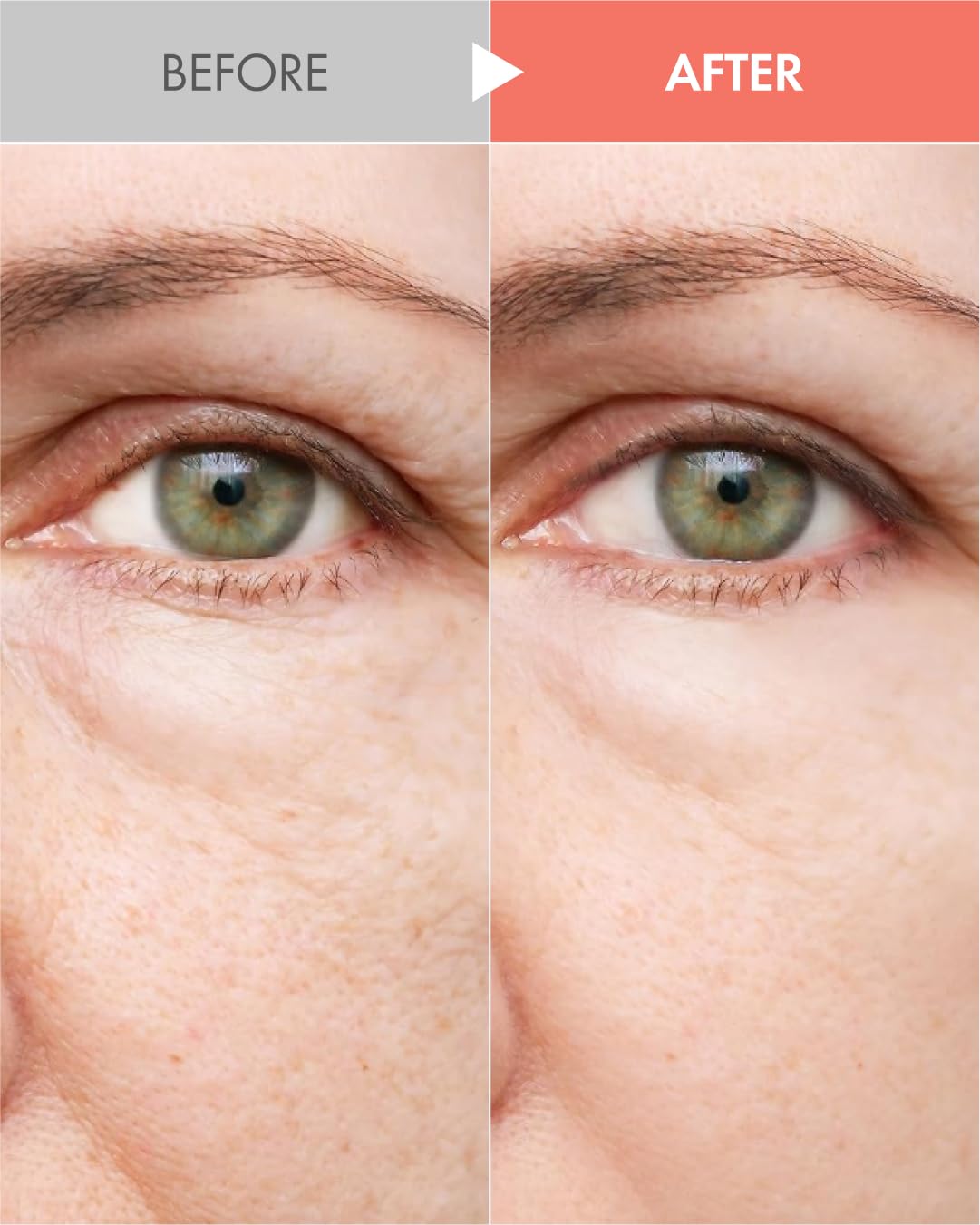 It'S Skin Collagen Nutrition Emulsion + 5.07 Fl.Oz, Boosts Collagen And Adenosine For Face Lift Helps Fine Lines Supports Skin Elasticity Rich Deep Nutrition, Korean Skincare : Beauty & Personal Care