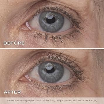 Younique Quadra 4-In-1 Mascara | Serum, Primer, Tubing, And Mascara | Boosts Volume, Length, And Lift Of Lashes | Biotin Serum | Primer & Tubing Mascara In Black For Healthy Eyelashes : Beauty & Personal Care
