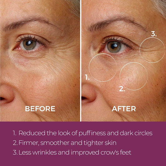 Blinc Eye Repair Peptide Complex | Clean, Vegan, Eye Cream | Anti-Aging, Anti-Wrinkle, Ultra Hydrating | Reduces Fine Lines, Dark Circles & Puffiness | Brightens, Firms & Evens Skin | 15 G / 0.53 Oz