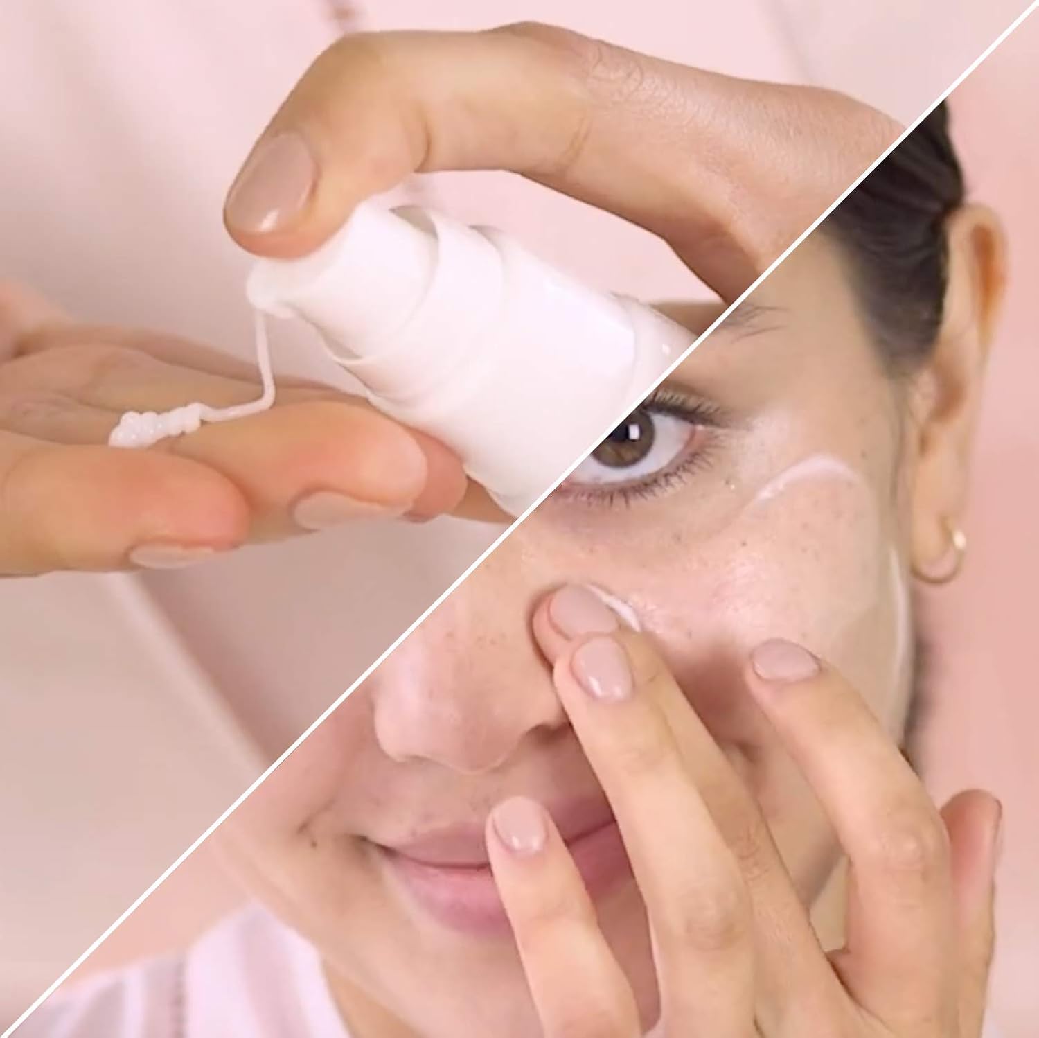 Nxn Acne Edit Overnight Treatment Cream With Glycolic, Salicylic, Lactic Acids & Probiotics To Clear Breakouts & Calm Redness - For Men, Women, Teens : Beauty & Personal Care