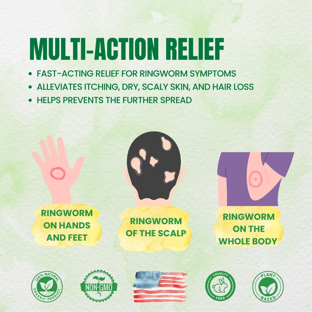 Forces Of Nature Ringworm Treatment For Humans, Organic Homeopathic Medicine, 0.37 Fl Oz, Antifungal Multi Symptom Relief From Itchy, Red & Irritated Skin Associated With Ringworm, Non Gmo