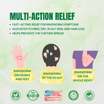 Forces Of Nature Ringworm Treatment For Humans, Organic Homeopathic Medicine, 0.37 Fl Oz, Antifungal Multi Symptom Relief From Itchy, Red & Irritated Skin Associated With Ringworm, Non Gmo