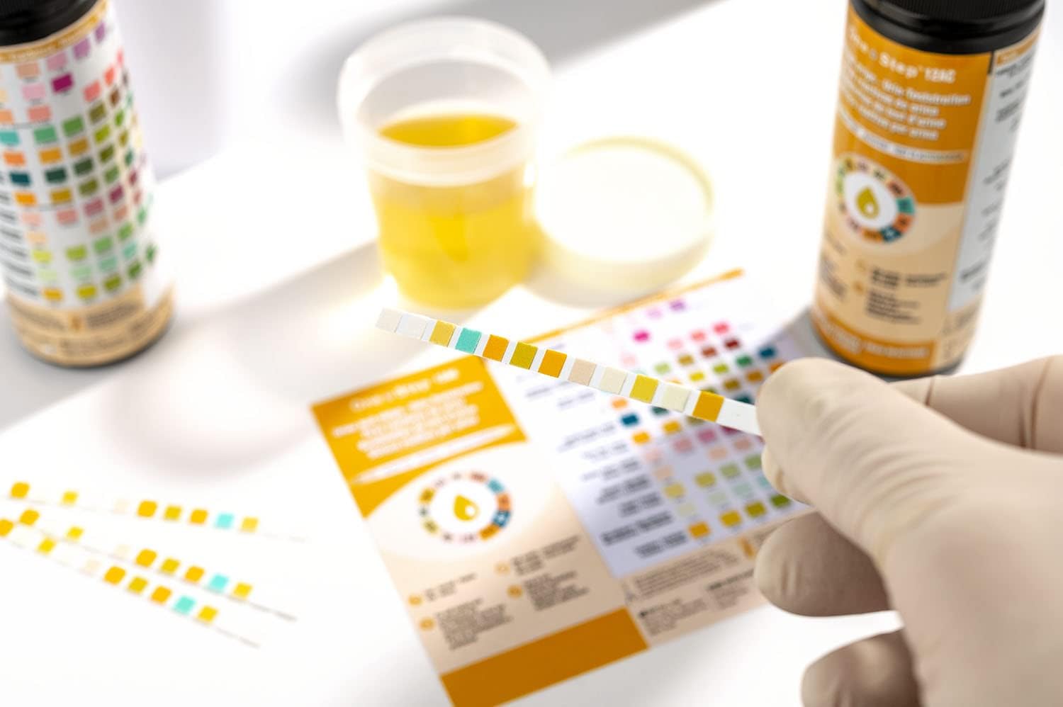12 Parameter Urine Test Strips Creatinine, Microalbuim, UTI Infection, Ketone, Blood, Glucose Testing Sticks (200 Tests - 2 Tubs) : Amazon.co.uk: Health & Personal Care