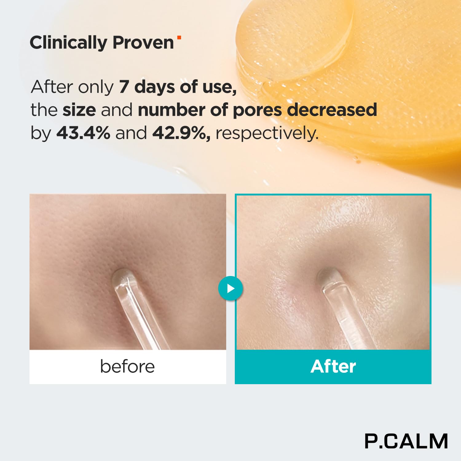 P.Calm Retinolagen Ampoule Pad 60 Patches | Vegan Fragrance-Free Pore Tightening Hydrogel Under Eye Patch With Retinol, Vegan Collagen, Bakuchiol | Korean Skincare Cruelty-Free