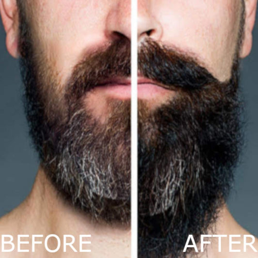 Arlo'S 2-In-1 Beard Wash And Conditioner 12 Oz. - Pro Growth Formula