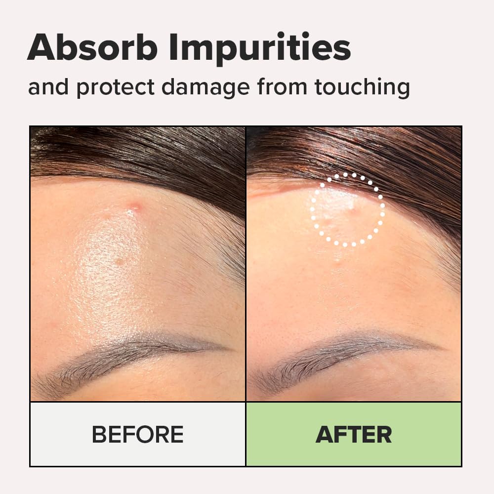 I Dew Care Blemish Skincare Set - Ready Aim Clear | Face Mask & Acne Patch & Pimple Popper Tool, With Tea Tree Oil, Soothing & Hydrating, Treatment, Oily & Sensitive Skin : Beauty & Personal Care