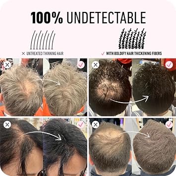 BOLDIFY Hair Fibers (12g) Fill In Fine and Thinning Hair for an Instantly Thicker & Fuller Look - Best Value & Superior Formula -14 Shades for Women & Men - MEDIUM BROWN : Beauty & Personal Care