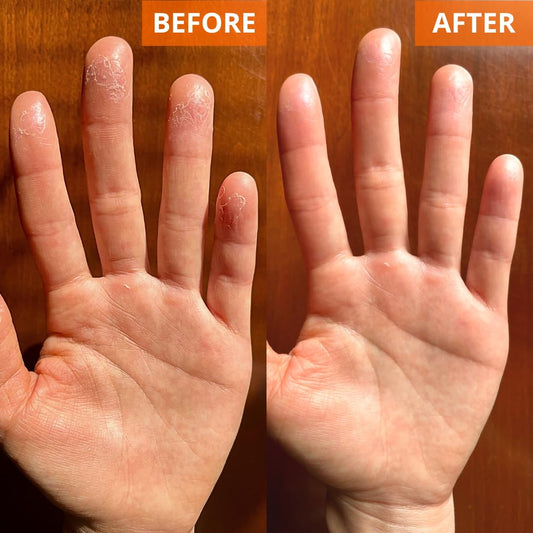 Yu-Be Moisturizing Skin Cream 4.4 Fl. Oz. Jar I Deeply Hydrating Non-Greasy Moisturizer For Severely Dry Skin I Soothing Camphor Calms, Cools, & Relieves Skin I Vitamins Repair & Nourish (2)