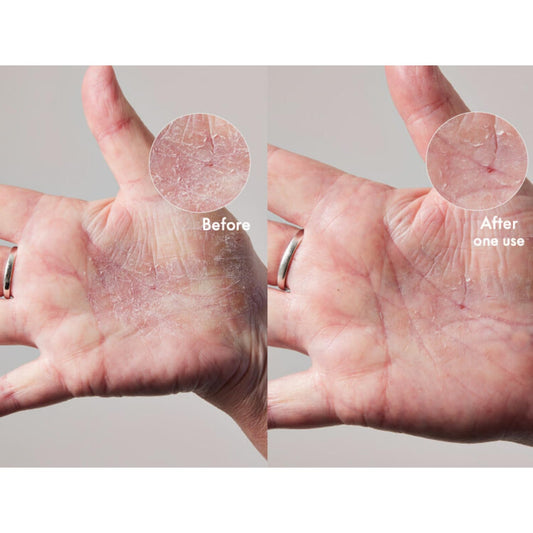 Lanolips 101 Dry Skin Super Cream - Body Cream & Face Moisturizer - Whipped Body Butter For Dry Skin - Triple Lanolin, Sweet Almond Oil, Shea Butter & Vitamin E Infused Body Care (2.02 Oz)