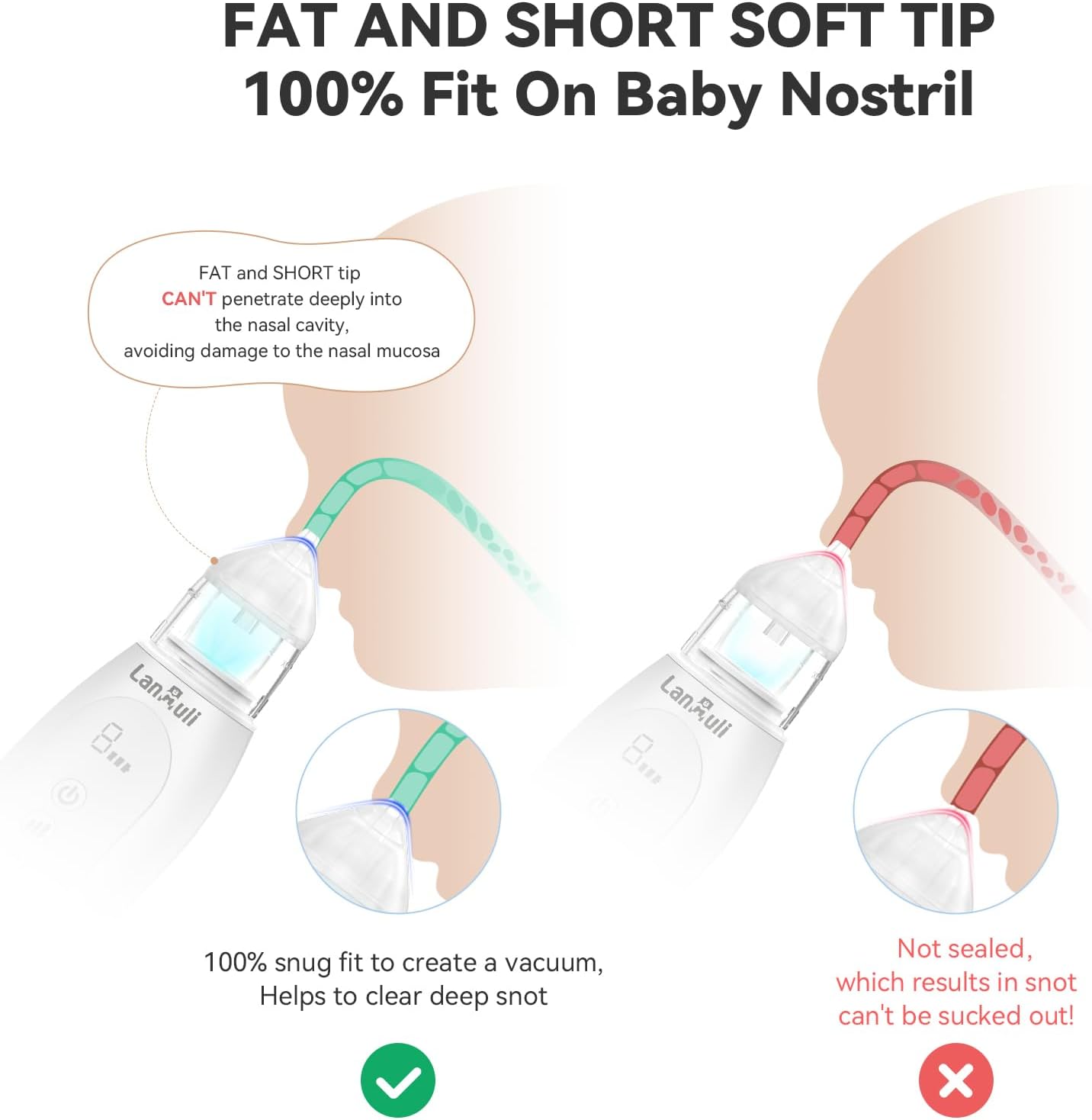 LANMULI Hospital-Grade Nasal Aspirator for Baby, Automatic Toddler Nose Sucker, Infant Snot Cleaner with Adjustable Suction Level, Music and Light Soothing Function (White) : Baby