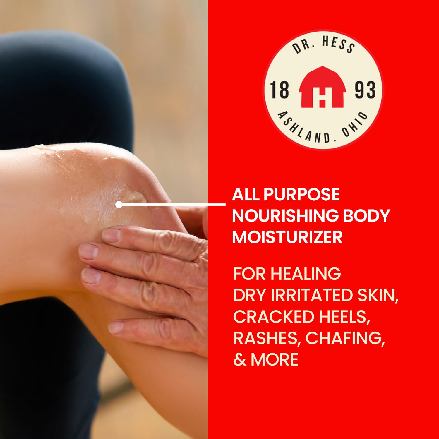 Dr. Hess' 1893 Original Udder Ointment, All-Purpose Nourishing Body Moisturizer For Healing Dry, Irritated Skin, Cracked Heels, Rashes, Chafing With Lanolin, Beeswax, & Eucalyptus Oil, 1.4 Oz : Beauty & Personal Care