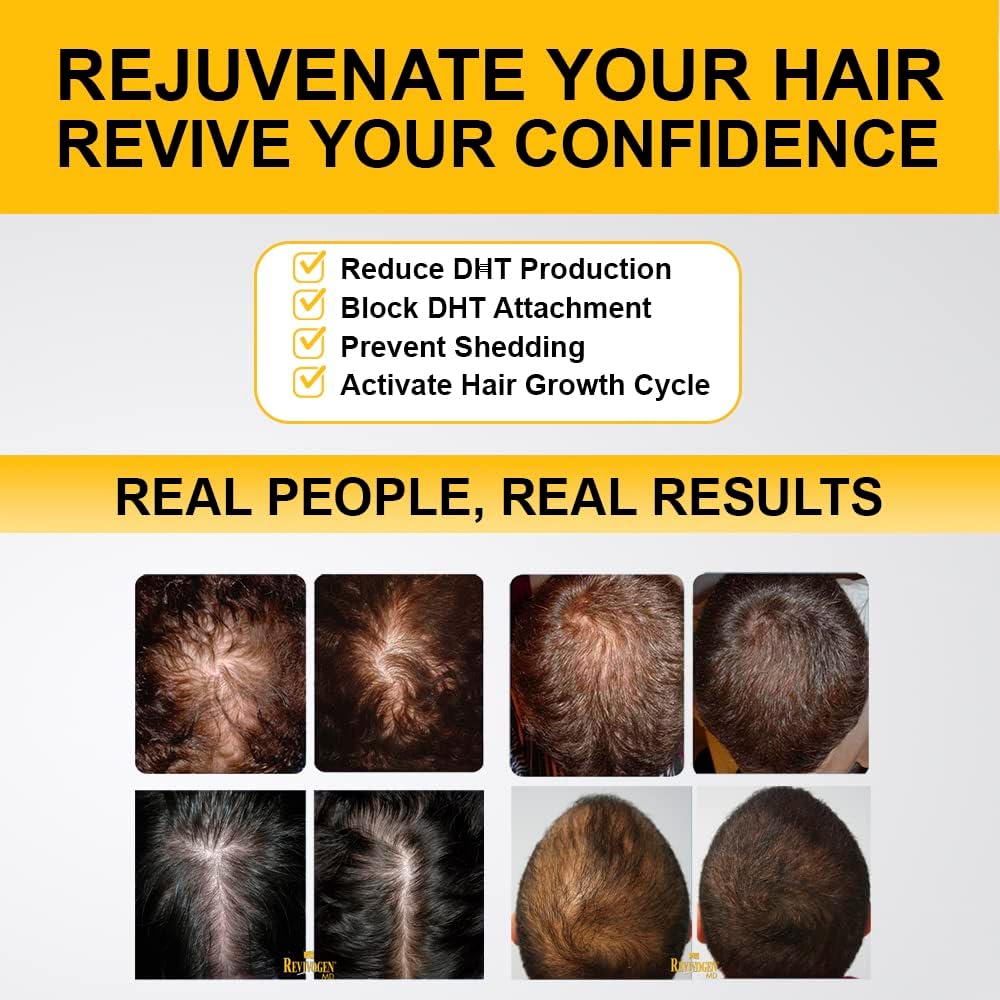 Revivogen Hair Loss Treatment Revitalising Anti-Dht Formula