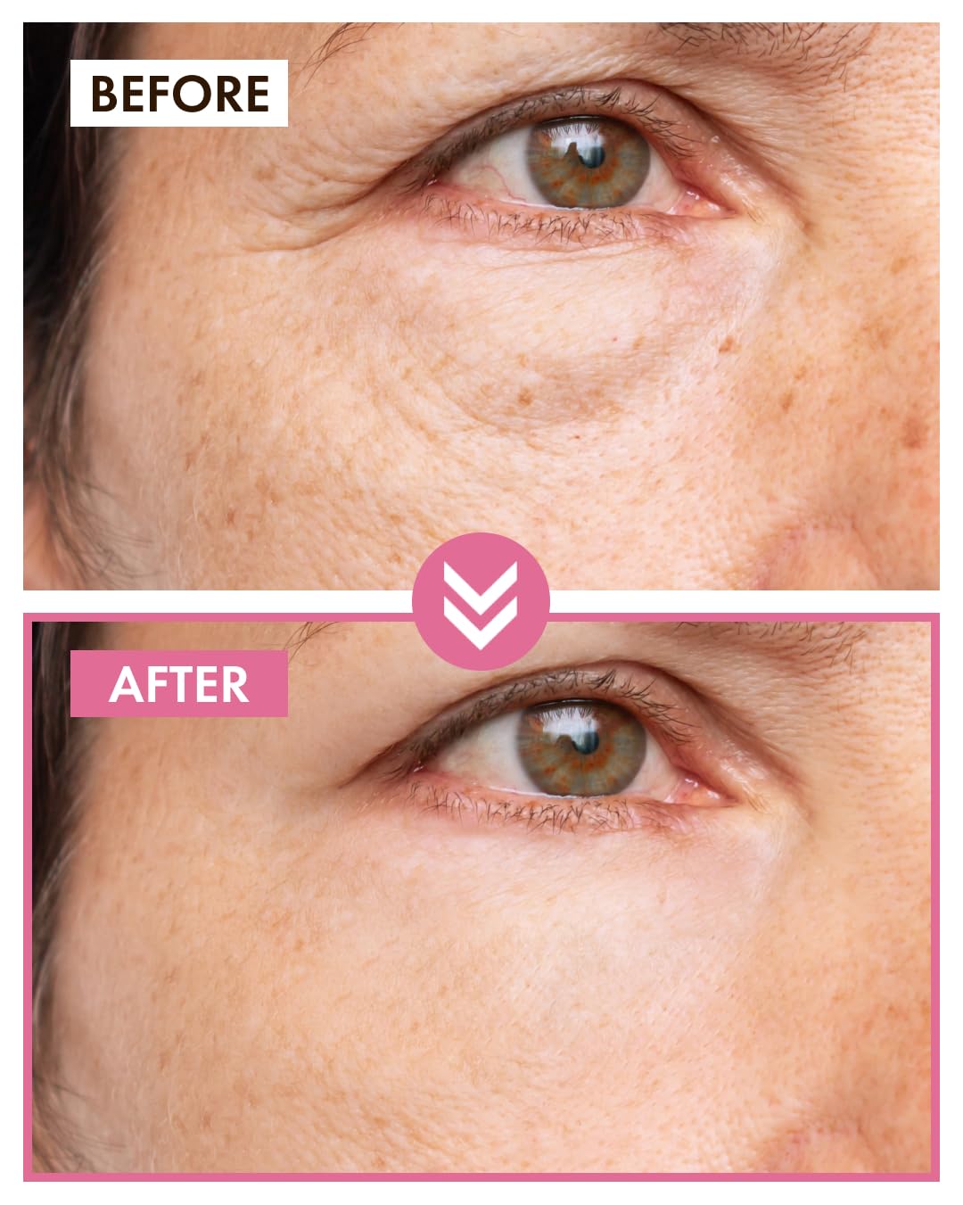 It'S Skin Peptide Collagen Moisturizer 1.69 Fl Oz. | Collagen Face Cream & Organic Face Moisturizer | Face Wrinkle Cream & Lightweight Moisturizer For Face | Korean Face Cream & Face Wrinkle Remover : Beauty & Personal Care