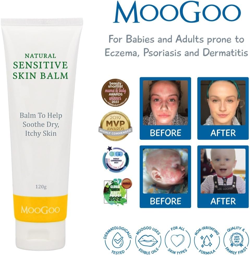 MooGoo Natural Sensitive Skin Balm - Relief for Dry, Itchy Skin with Soothing Ingredients. Also Suitable for Babies & Adults prone to Eczema, Dermatitis & Psoriasis, 120g / 4.2oz. : Amazon.co.uk: Health & Personal Care