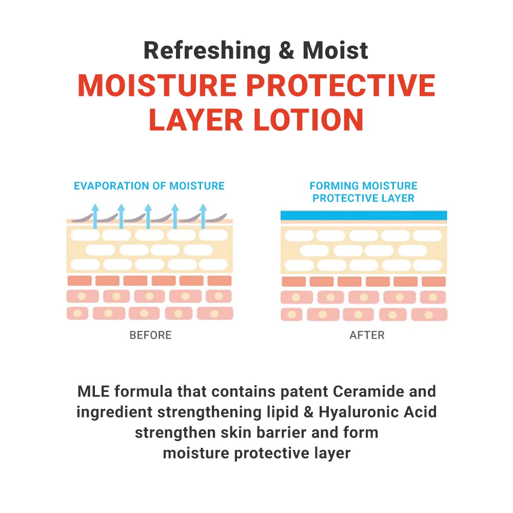 Atopalm Mle Lotion 120Ml 4.05 Fl Oz For Sensitive Skin, 48 Hours Long Hydration With Ceramide, Long-Lasting Moisturizing Body Lotion, Strengthening Skin Barrier, Redness-Relief, Korean Skincare