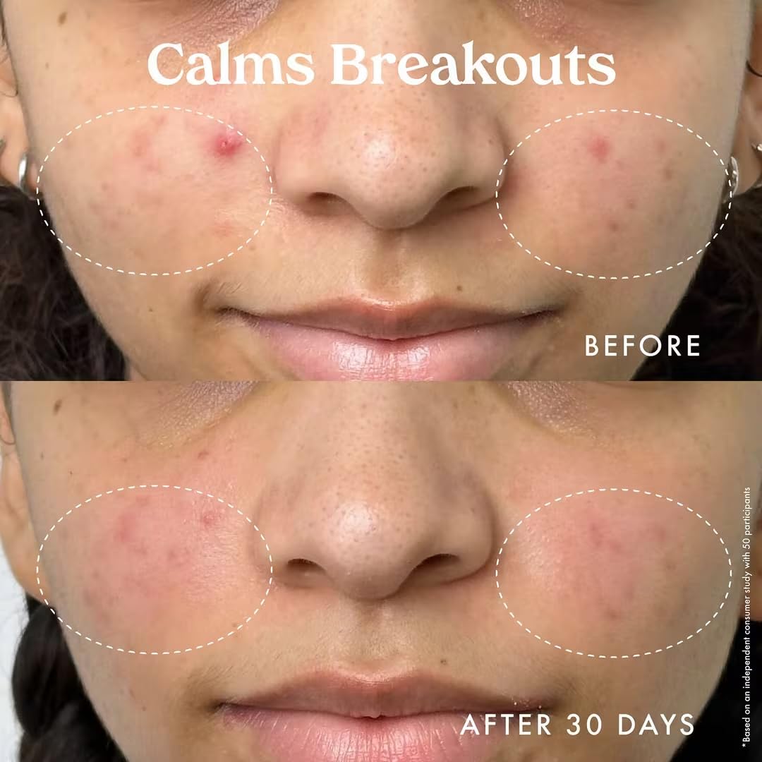 Kopari Star Bright Vitamin C Moisturizer With Starfruit & Niacinamide, Lightweight Formula Melts Into Skin, Brighten & Even Complexion, 1.7Oz : Beauty & Personal Care