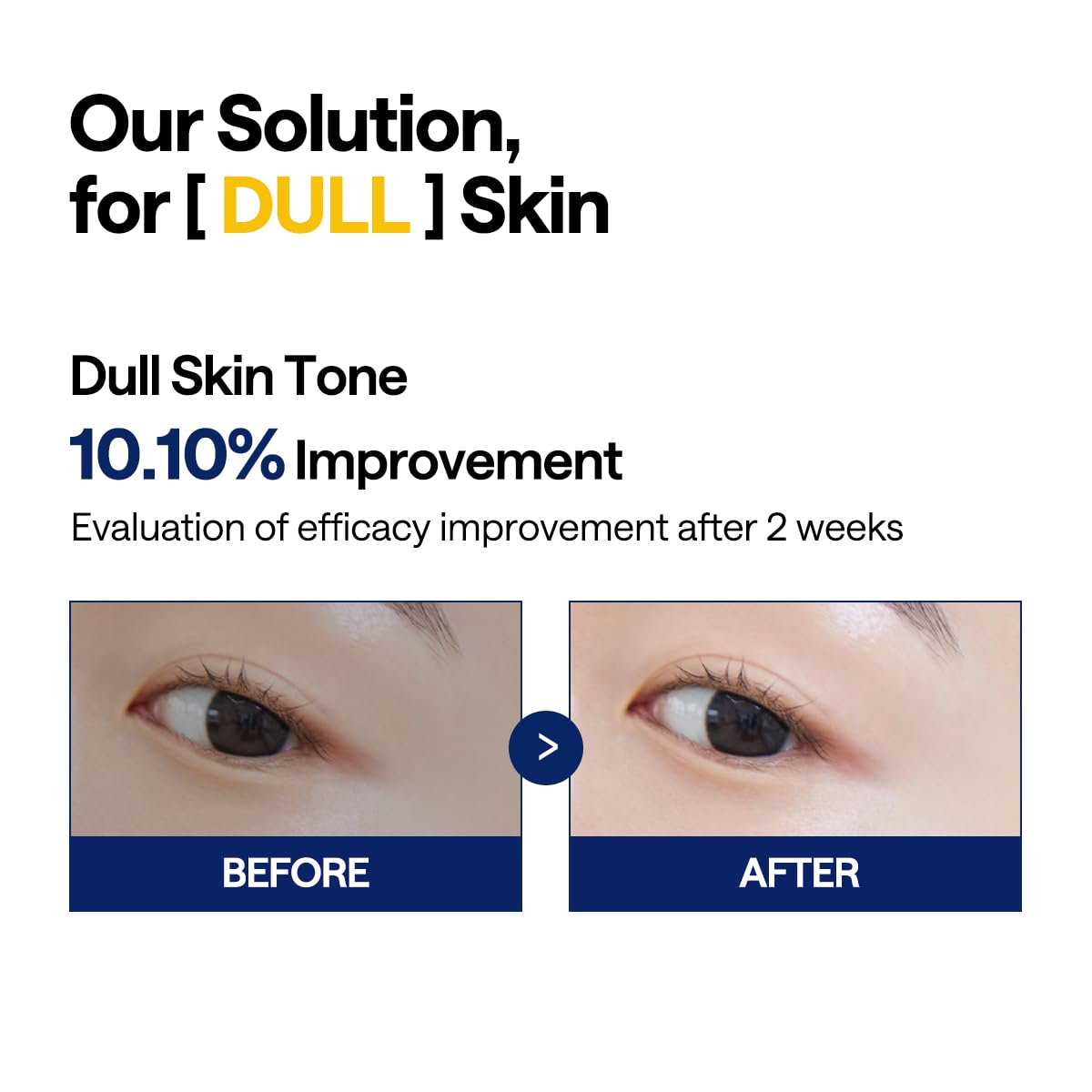 Mediheal Vitamide Brightening Pad - Vegan Face Hypoallergenic Pads With Niacinamide, Sea Buckthorn - Radiance Boosting Pads For Clear, Illuminating Skin 100 : Beauty & Personal Care