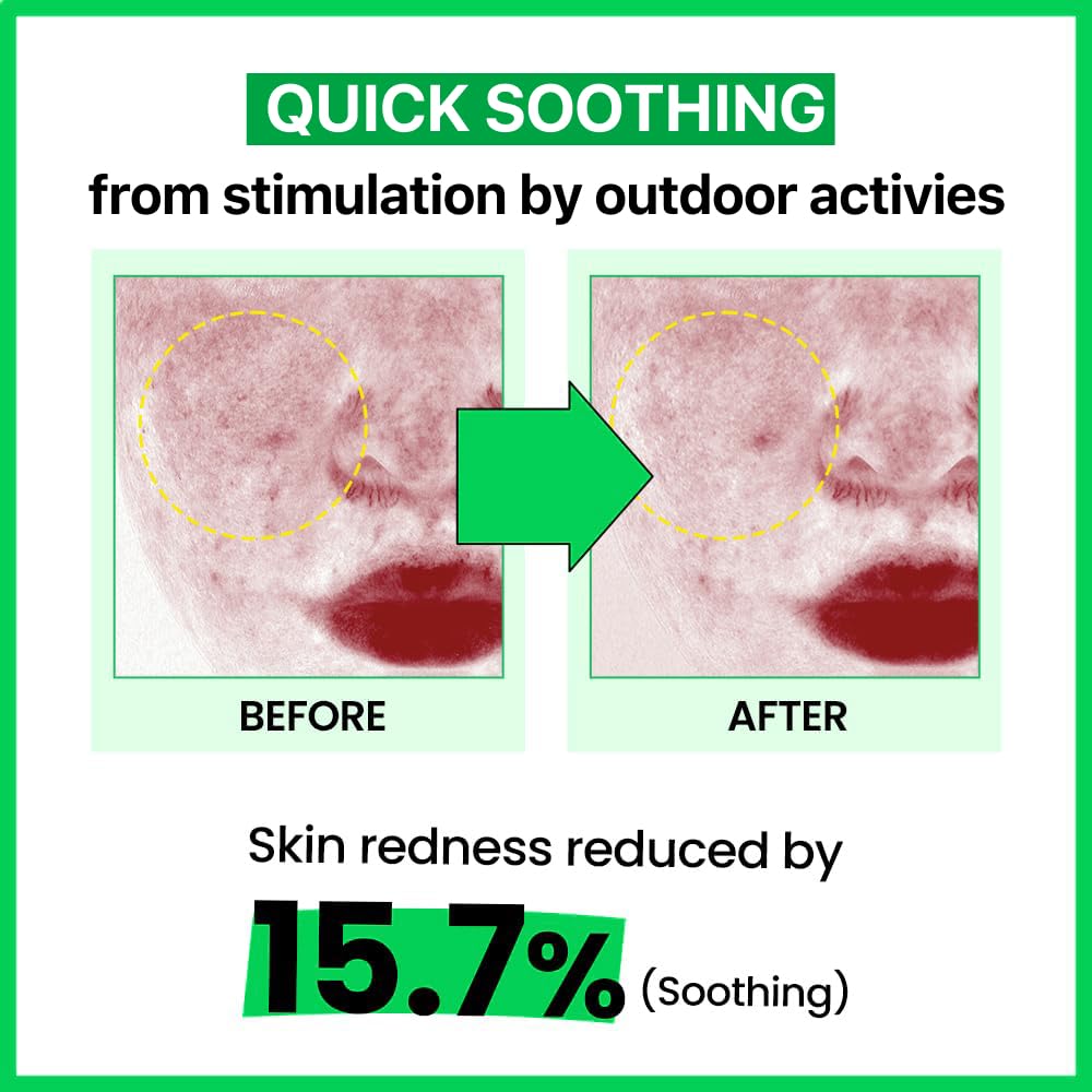 Real Barrier Cica Relief Rx Fade In Serum 50Ml 1.69 Fl. Oz. |Calming & Skin Recovery Face Serum, Instant Relief From Skin Irritation, Moisturizing & Soothing Serum For Sensitive Skin, Korean Skincare