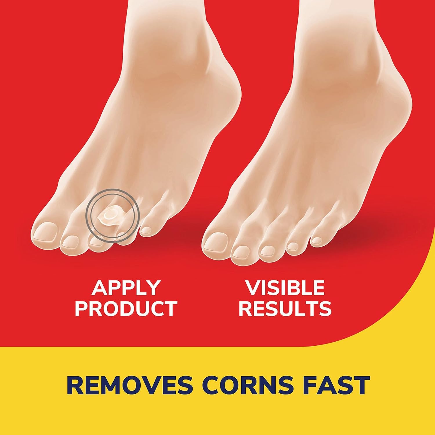 Dr. Scholl'S Corn Removers, 9 Ct // Removes Corns In As Few As 2 Treatments, Maximum Strength, Stays On All Day : Health & Household