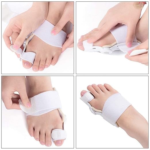 Big Bone Toe Bunion Splint - Orthopedic Toe Straightener for Hallux Valgus Correction, Pain Relief, and Foot Support (White)