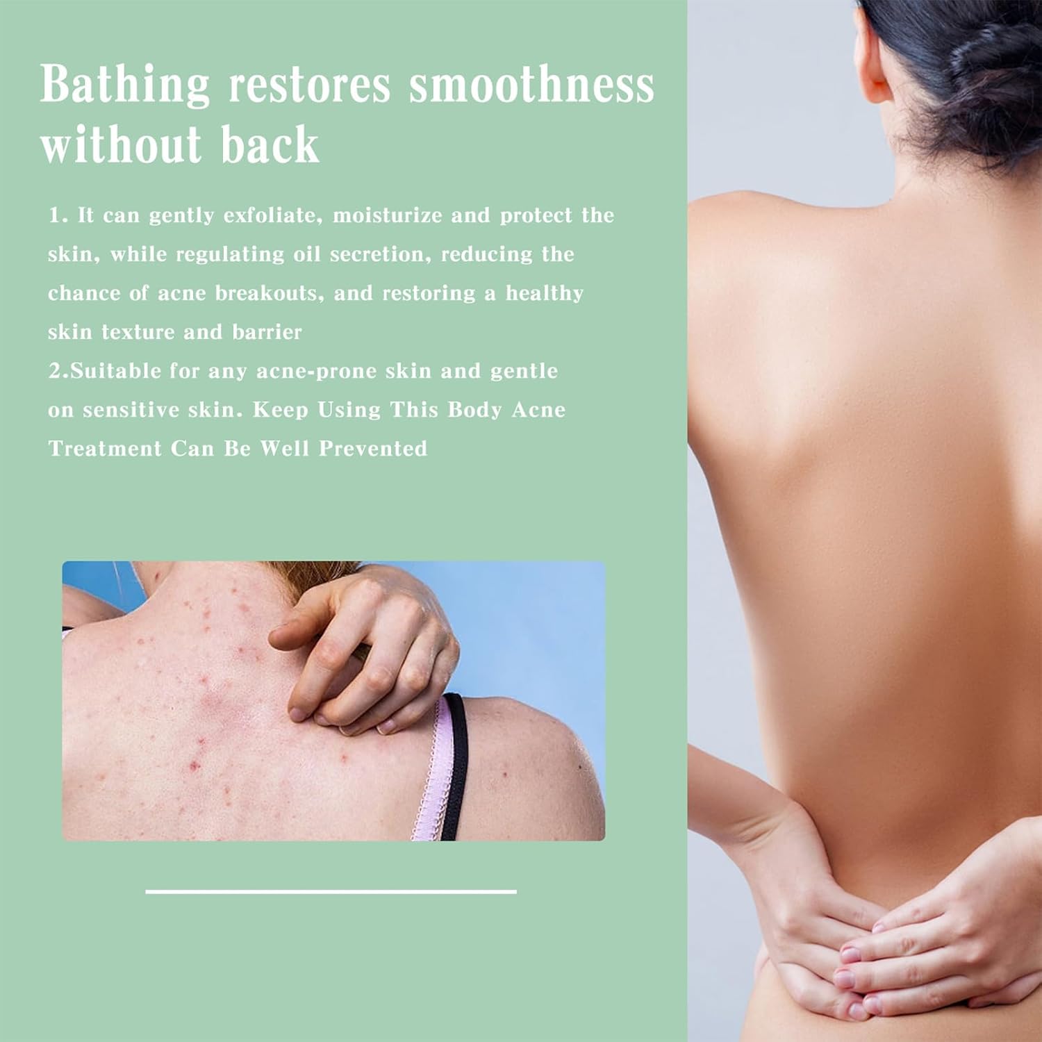Back Acne Treat-Ment Spray, Lighten Acne Marks Skin Care Spray, Herbaluxy Back Acne Treat-Ment, Body Moisturiser For Dry Skin, Repair Back Shoulder Acne & Body Acne & Chest Acne & Butt Acne (2Pcs)