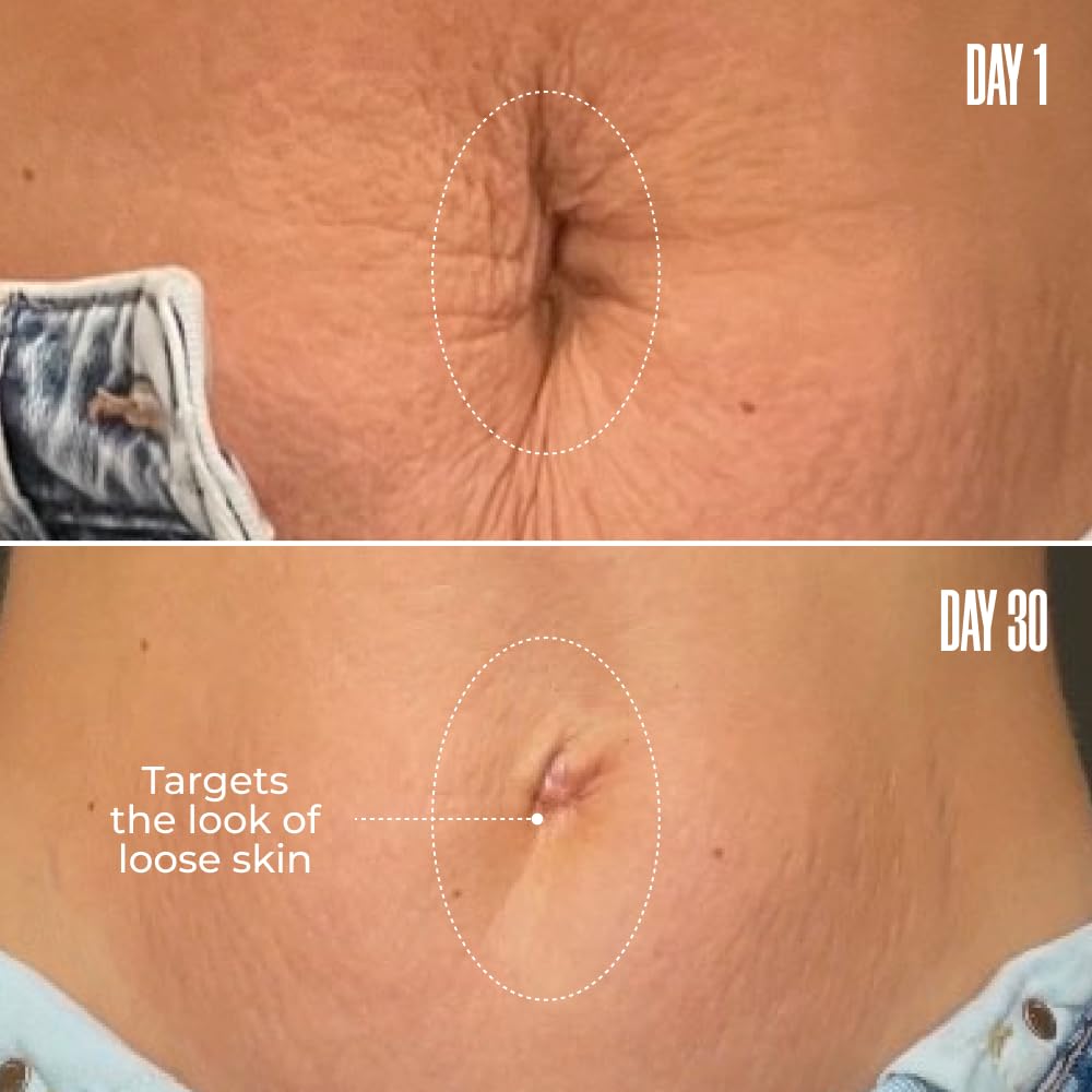 Maëlys Cosmetics B-Flat Belly Firming Cream - Stretch Mark Belly Cream - Tightening : Everything Else