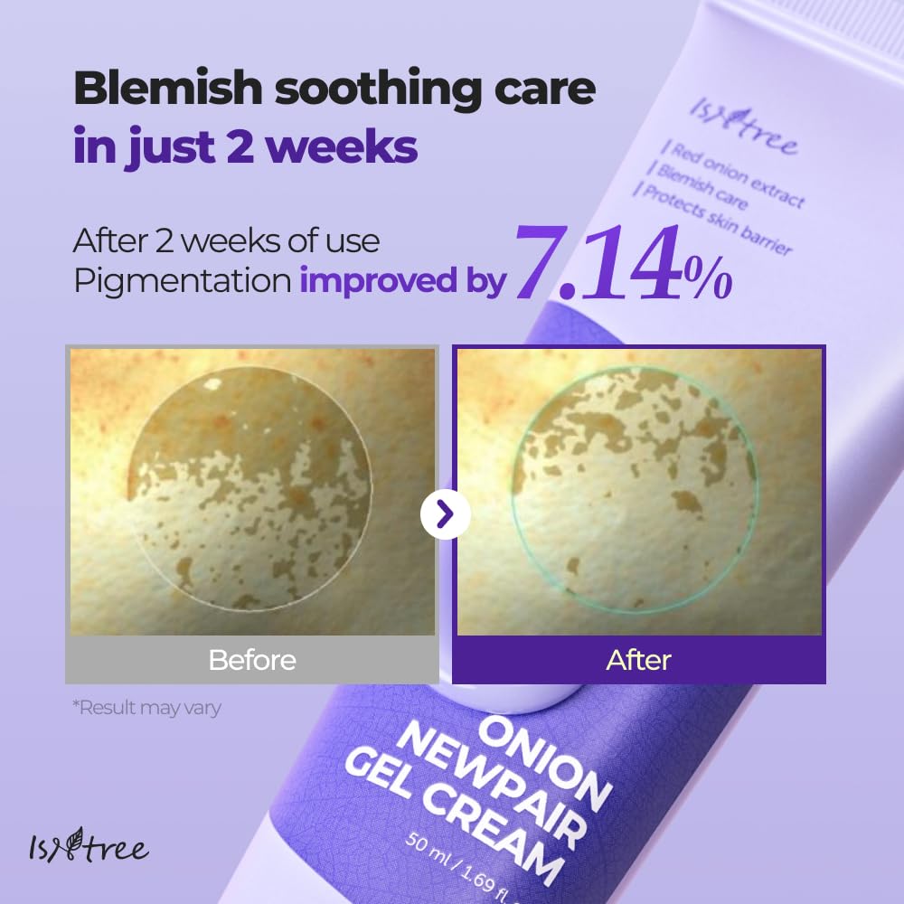 Isntree Onion Newpair Gel Cream 50Ml 1.69 Fl.Oz - Soothing Care | 3-Layer Hyaluronic Acid| Moisturizing | 71 % Red Onion Extract | Non-Sticky & Non-Greasy L Skin Hydration I Korean Skincare : Beauty & Personal Care