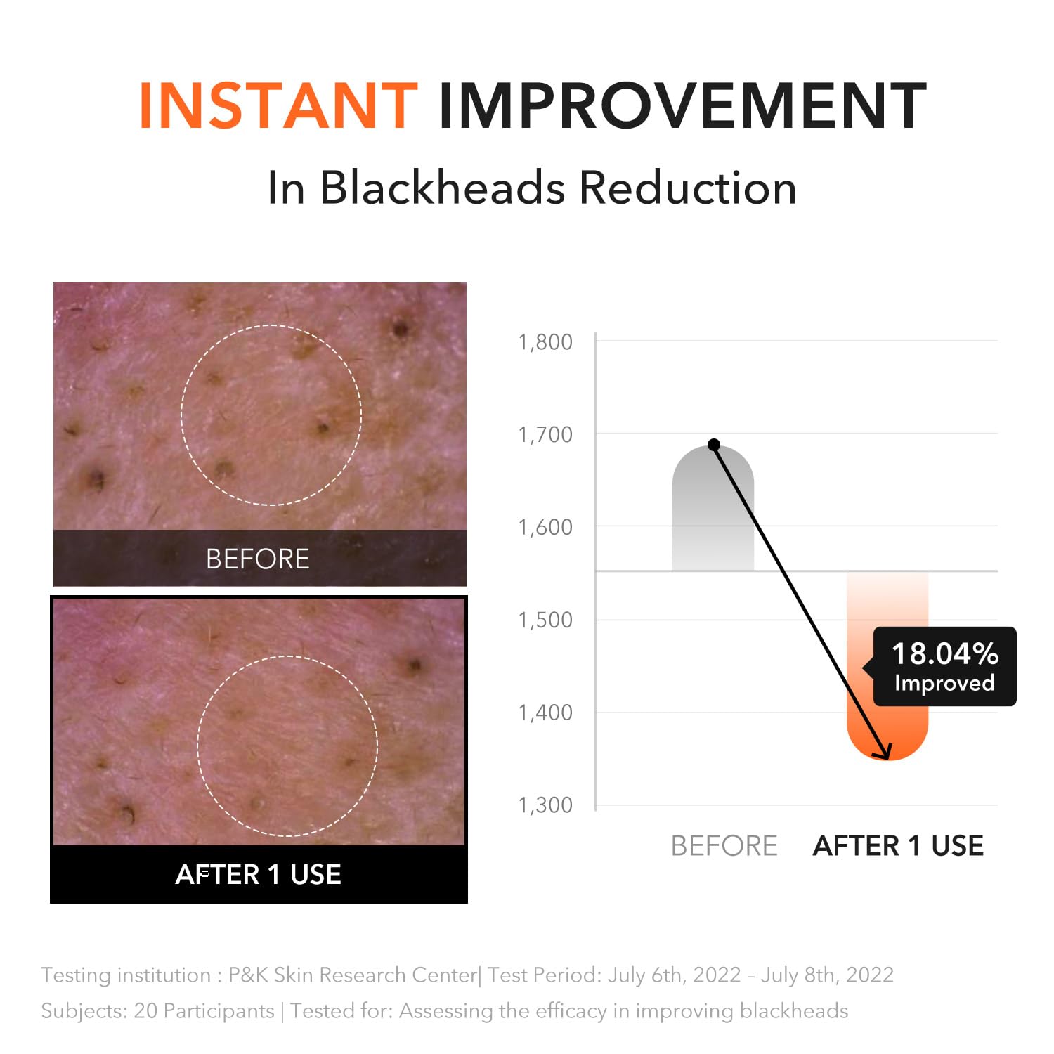 Aprilskin Double Cleanse Duo – Carrotene Ipmp™ Hydromelt Cleansing Balm & Pink Aloe Facial Polish Cleanser, Hydrating And Gentle Care For Fresh, Radiant Skin : Beauty & Personal Care