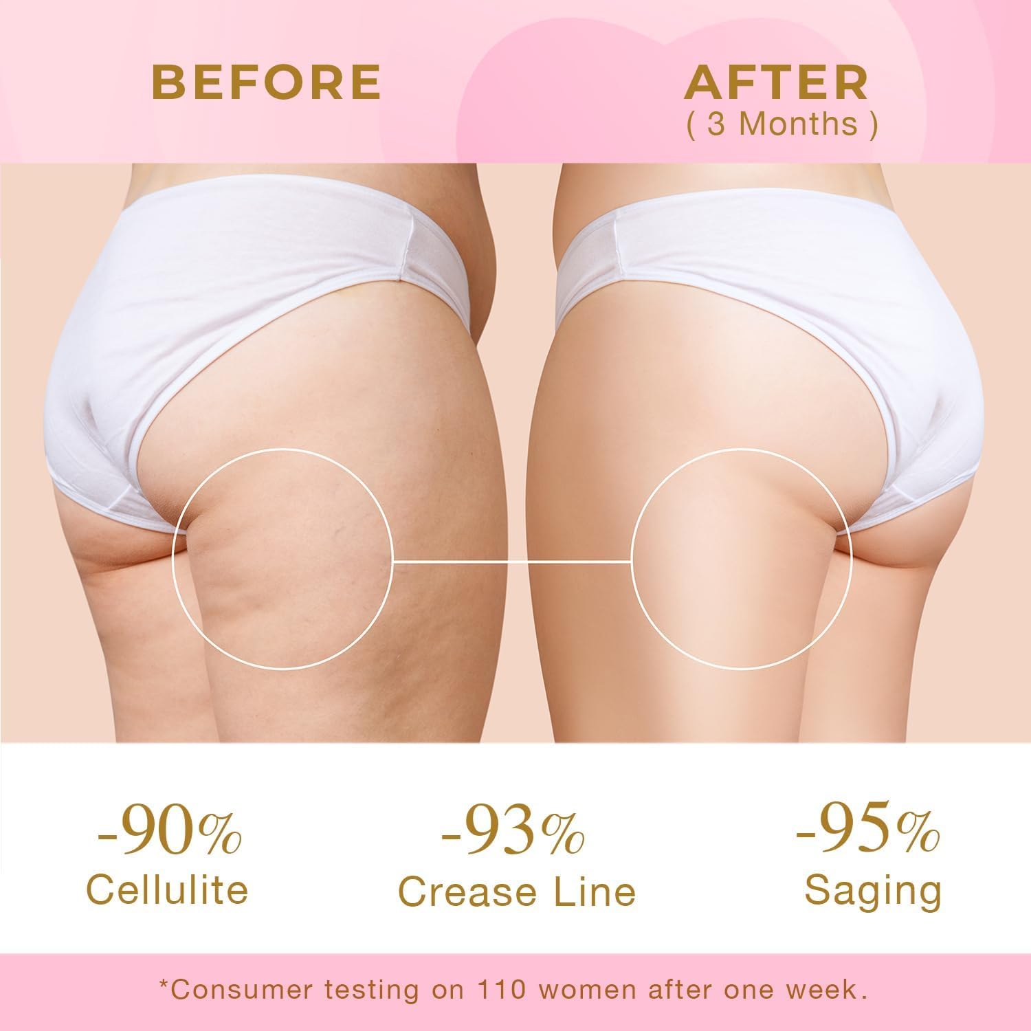 Skin Tightening Cream For Body: Cellulite Cream For Toning And Lifting Thighs, Butt, And Legs – Reduces Sagging Skin And Enhances Curves For A Youthful Look : Beauty & Personal Care