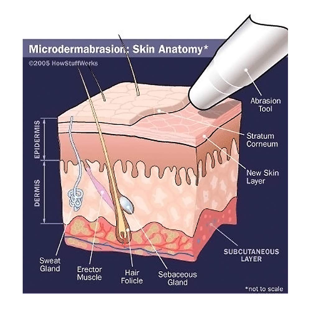 Needcrystals Microdermabrasion Crystals For Machines, All-Natural Facial Exfoliating Treatment For Dull Or Dry Skin, Wrinkles, Blemishes, Scars & More (4 Lb, 120 Grit) : Beauty & Personal Care