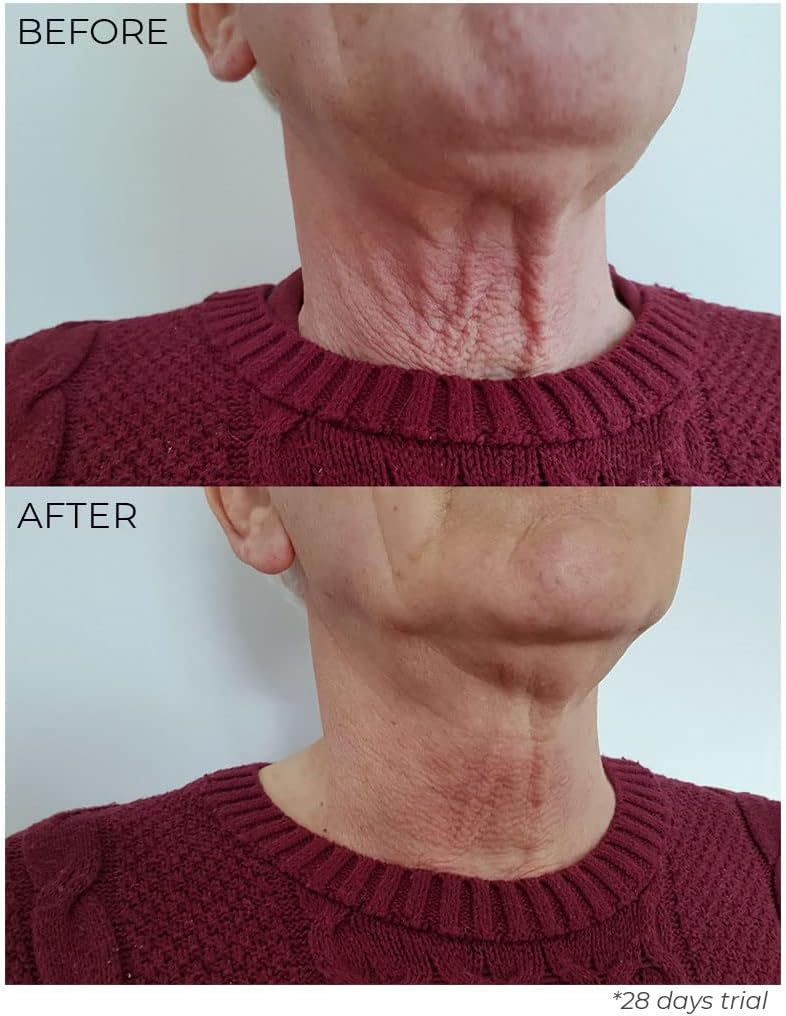 Nourish London TSL Tighten, Sculpt & Lift Neck Elixir 30ml | Anti Ageing Neck Cream | Kale & Griffonia Extracts | 100% Vegan | Cruelty-Free | Multi Award Winner | Firming Neck Cream - Neck Lift Cream : Amazon.co.uk: Beauty