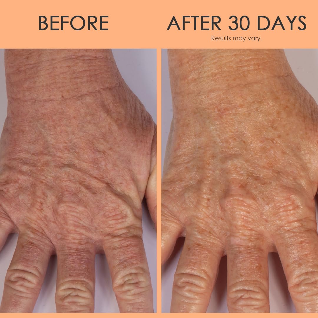 Crépe Erase Advanced Anti Aging Hand Repair Treatment with TruFirm Complex : Beauty & Personal Care