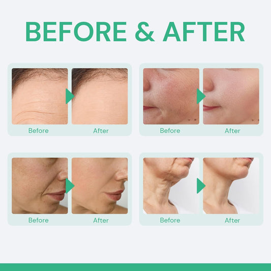 Retinol Cream For Face: Anti-Wrinkle Moisturizer For Deep Wrinkles, Dry Skin & Neck Firming For Men & Women