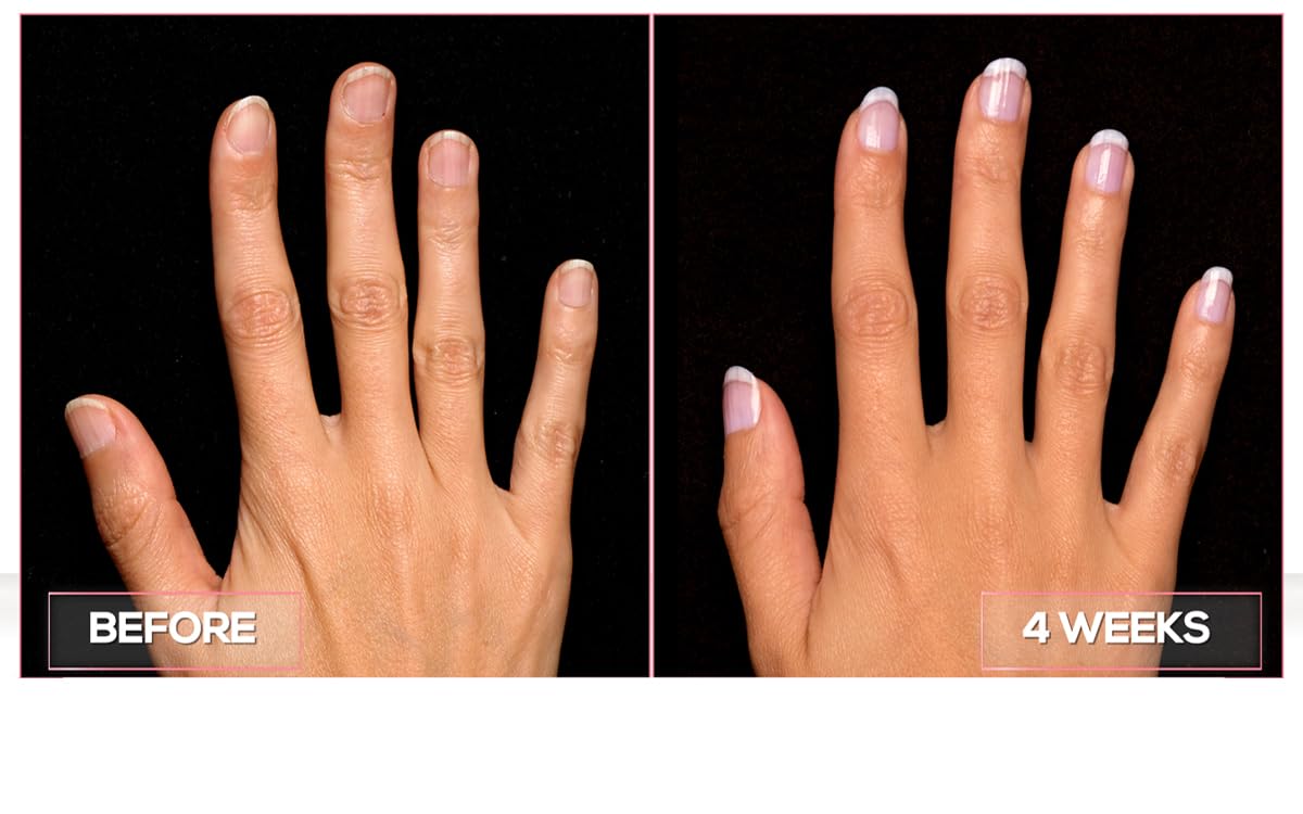 Perfect Formula Manicure Booster - Base And Top Coat Nail Strengthener, Keratin Treatment - Strengthener For Damaged Nails - Made In The Usa .60 Fl Oz. : Beauty & Personal Care