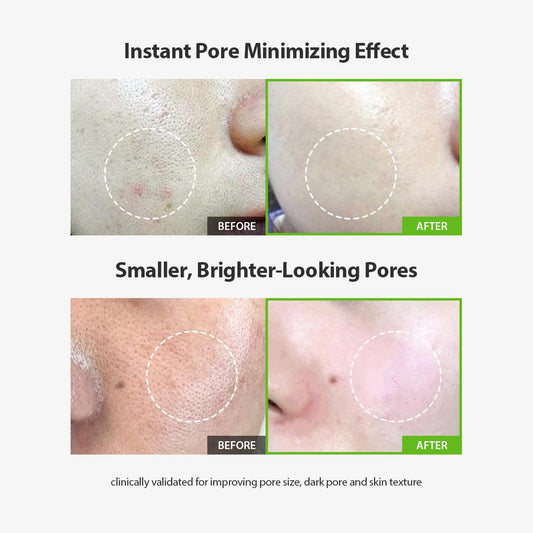 Sungboon Editor Green Tomato Pore Lifting Ampoule | Pore Minimizer Serum With Niacinamide & Green Tomato Extract | Hydrating & Firming Care For Sensitive Skin | Korean Skincare
