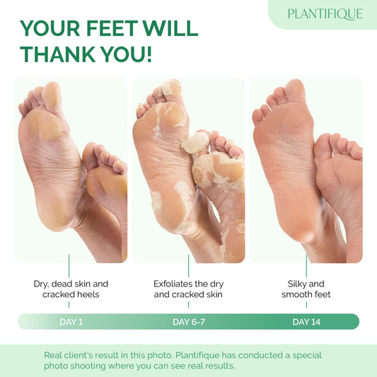 Plantifique Foot Peel Mask – 2 Pairs Exfoliating & Dermatologically Tested Foot Treatment, Removes Dead Skin & Repairs Heels For Soft Feet – Strawberry Scent, Gift For Women & Men