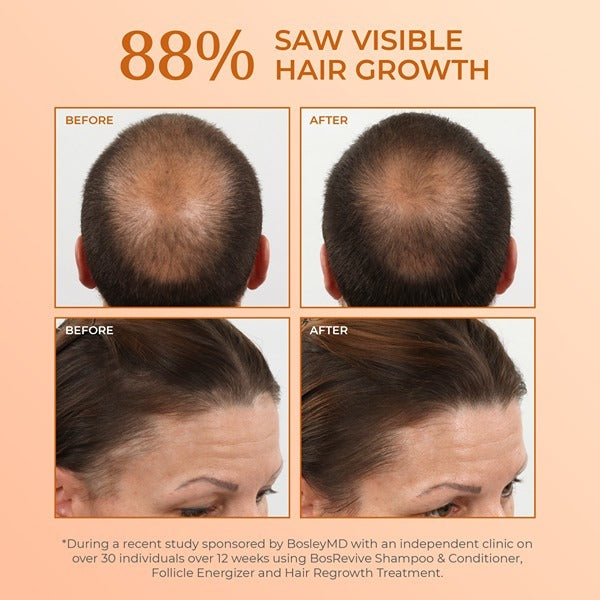 Bosleymd Hair Loss Conditioner Revive Colour Safe 300Ml