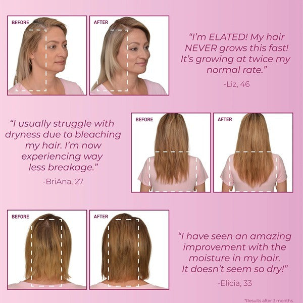 Bosleymd Hair Loss Prevention Starter Pack Mendxtend