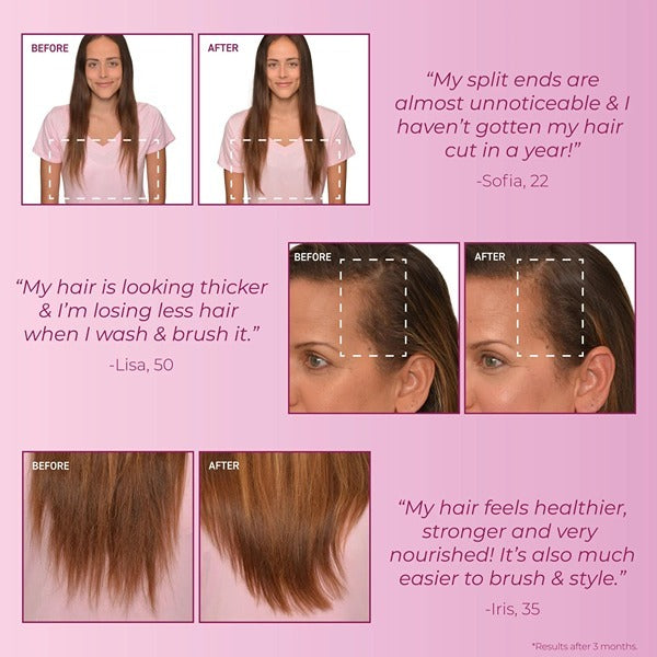 Bosleymd Hair Loss Conditioner Mendxtend 300Ml