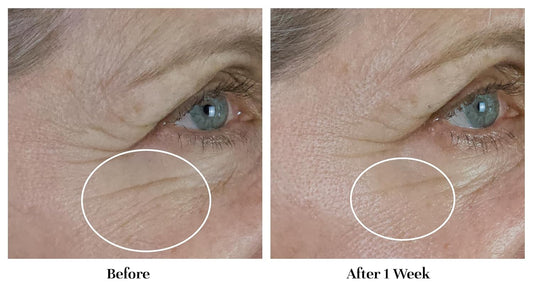 City Beauty Blue Defense Hydrogel - Gel Face Moisturizer - Hydrating Formula With Hyaluronic Acid - Solution For Dark Spots & Wrinkles - Cruelty-Free Skin Care For Blue Light Defense & Anti-Aging