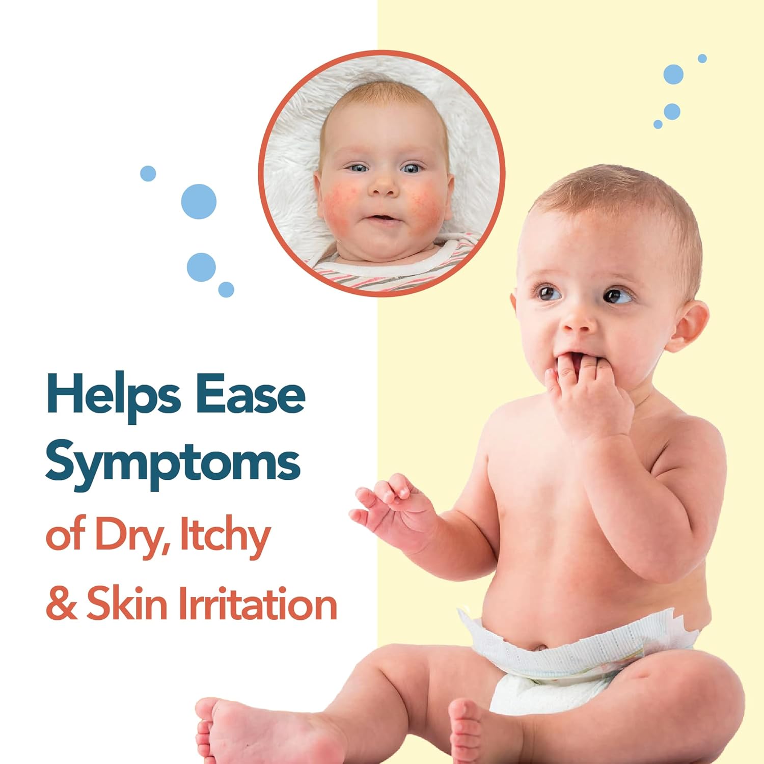 Happy Cappy Baby Shampoo And Body Wash - Shampoo & Body Wash For Eczema-Prone Skin, For Infants, Toddlers, & Kids, Reduces Itching And Redness, Dermatologist Tested, Fragrance Free - 8 Fl Oz : Baby