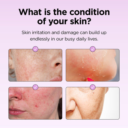 Farmskin Superfood For Skin Hyalusteen Repair Emulsion -Korean Skincare Moisturizer/Hydrationg Facial Lotion For All Skin Type (4.05Fl.Oz, 120Ml)