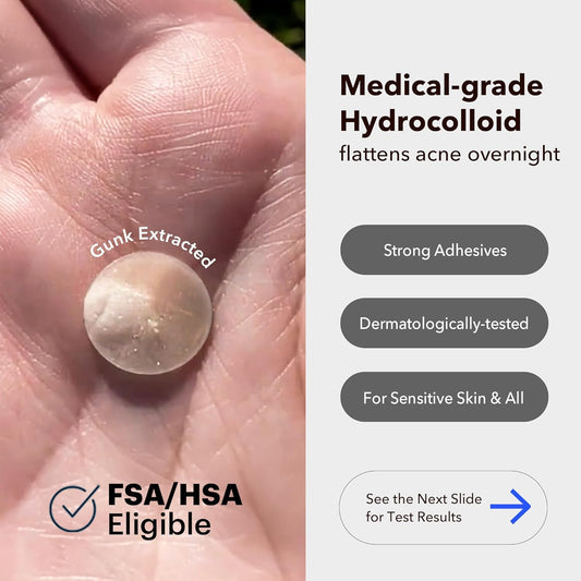 Avarelle Pimple Patches For Face | Hydrocolloid Acne Patches For Covering Blemishes | Fsa Hsa Zit Patches With Tea Tree, Calendula, & Cica | Hsa Store Eligible Items (10-14 Mm, 80 Count)