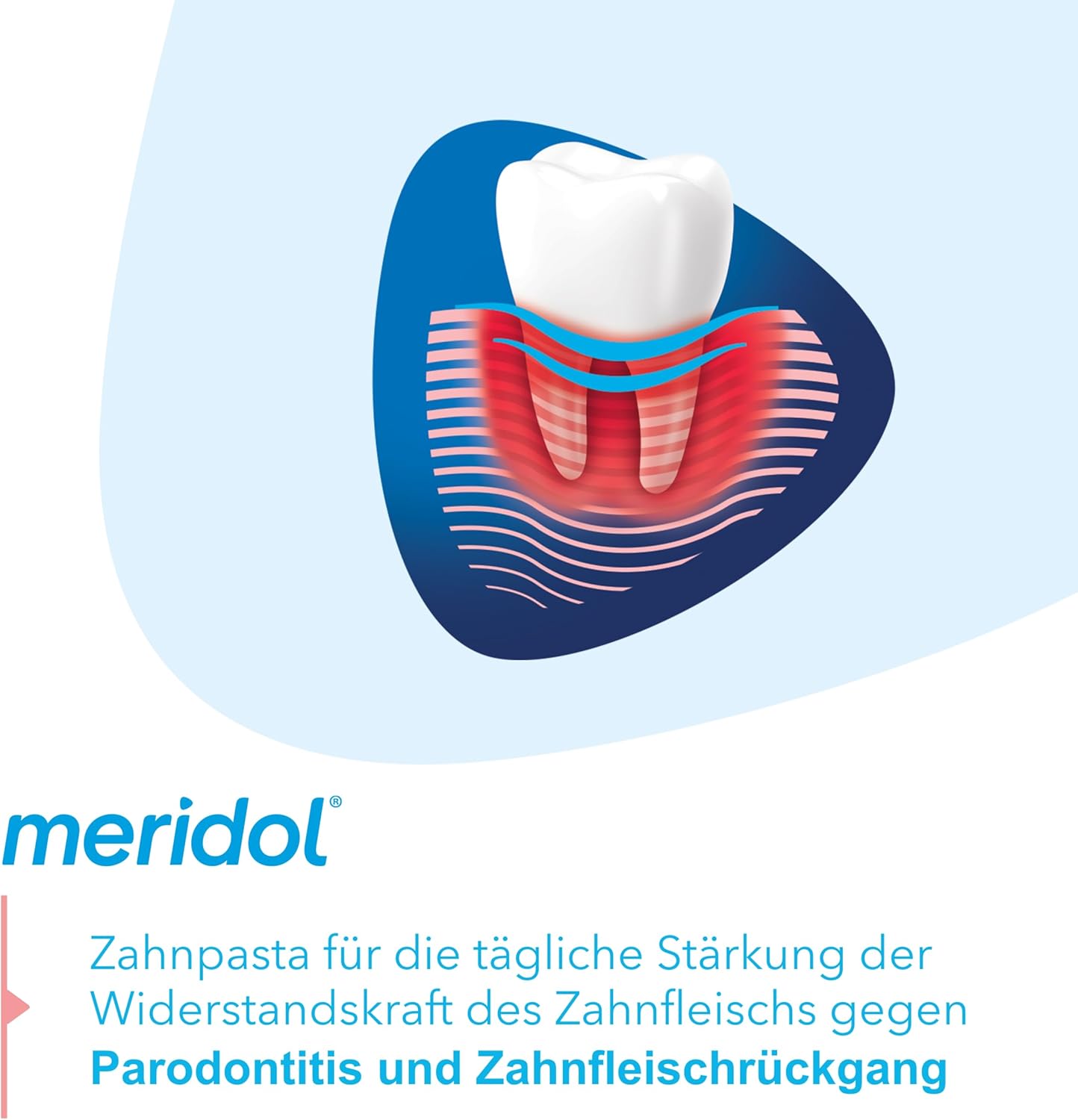 Meridol Toothpaste Periodont Expert 75 Ml - Toothpaste Has An Antibacterial Effect And Thus Supports The Natural Healing Process Of The Gums, Packaging May Vary