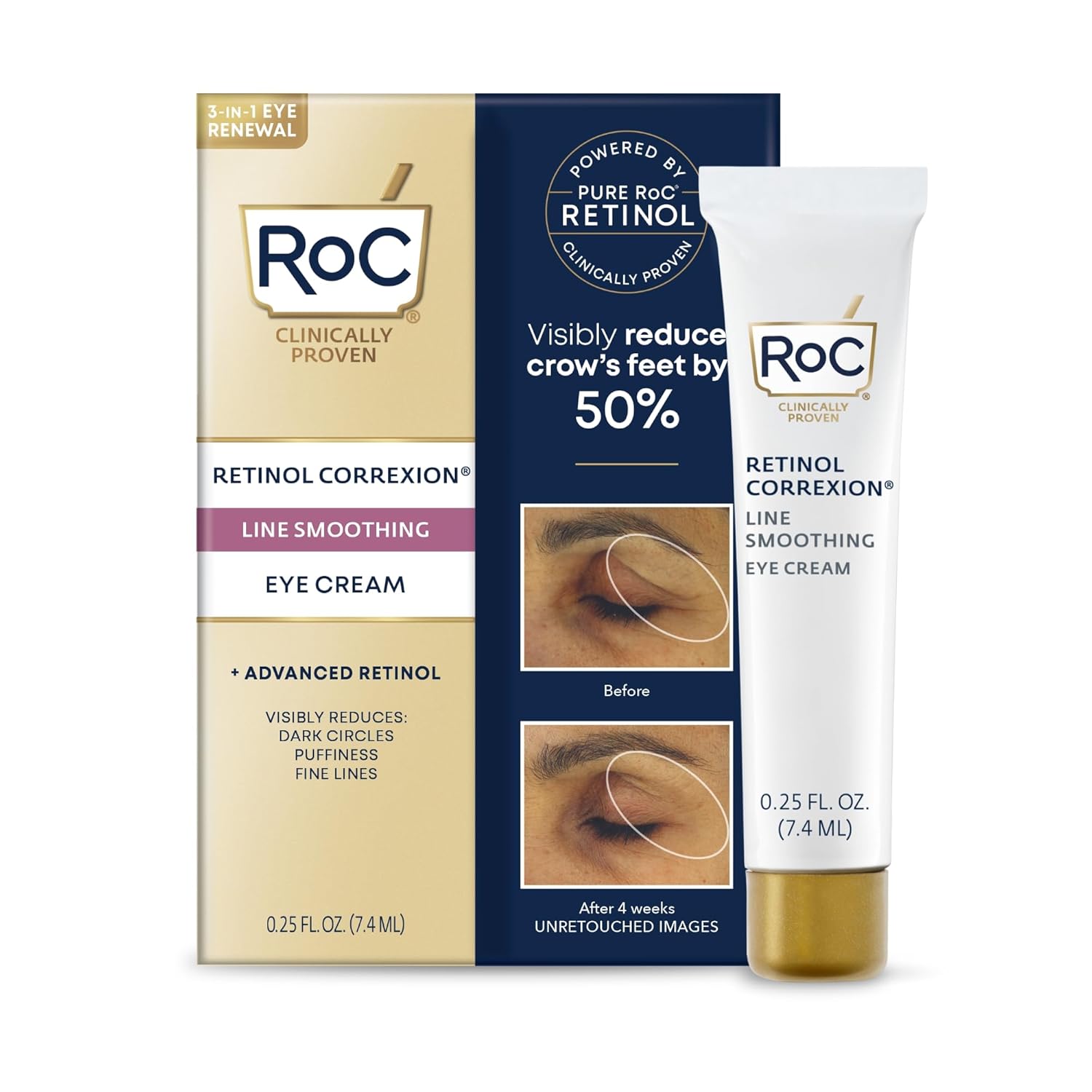 Roc Retinol Correxion Eye Cream Mini For Dark Circles & Puffiness, Daily Wrinkle Cream, Anti Aging Line Smoothing Skin Care Treatment, .25 Ounces